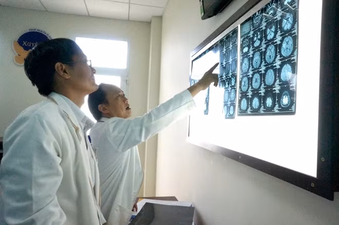 Các y bác sĩ BVXA phân tích kết quả chụp CT-Scaner cho bệnh nhân.