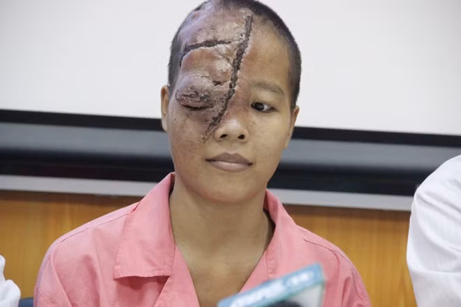 Sau 21 năm mang nỗi đau bất hạnh vì bệnh tật, Trang đã có nụ cười trở lại.