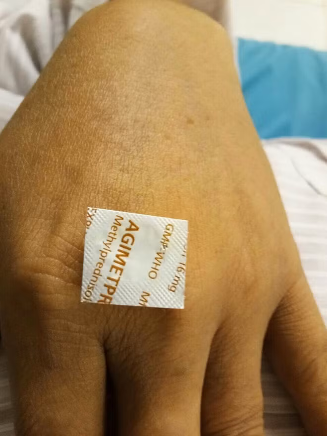 Viên thuốc còn nguyên cả vỏ sắc cạnh được lấy ra khỏi vùng thực quản bệnh nhân.