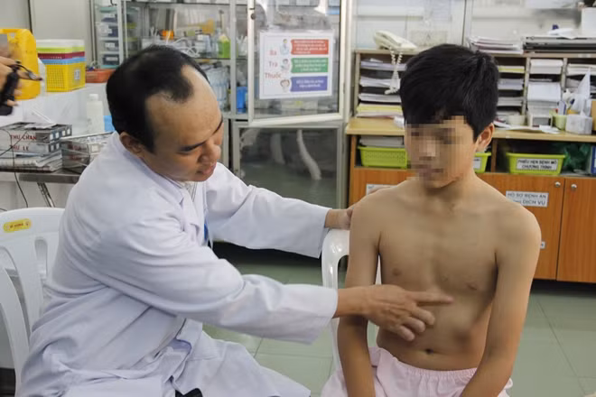 Bệnh lý lõm ngực nếu không được điều trị kịp thời có thể gây nhiều tai biến nguy hiểm.
