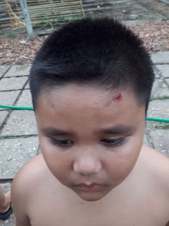 Con trai của anh T. cũng bị mảnh vỡ văng trúng vào trán