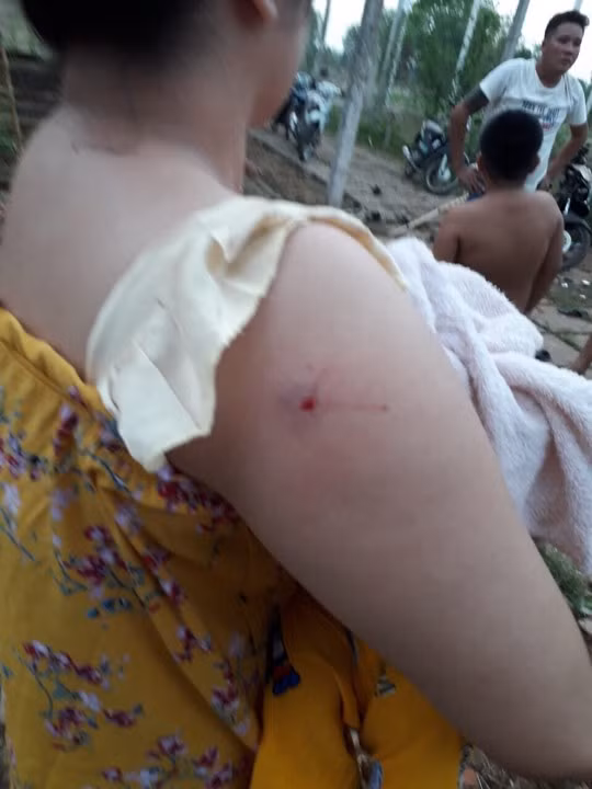 Những mảnh vỡ văng trúng vào người nhà anh T.