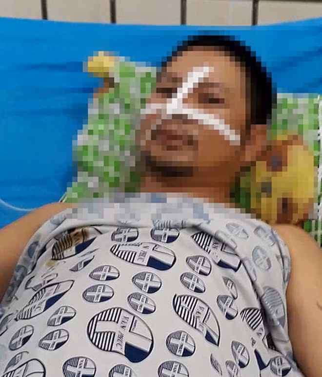 Anh Hoa đang điều trị tại bệnh viện (ảnh X.T)