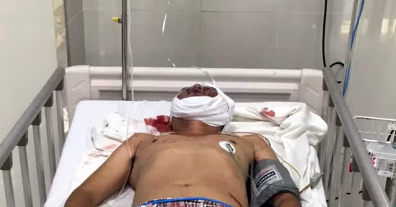 Lê Quang Dinh - đối tượng đã nổ súng tại vụ ẩu đả đang được điều trị tại bệnh viện vì bị chém trọng thương. Lê Quang Dinh - đối tượng đã nổ súng tại vụ ẩu đả đang được điều trị tại bệnh viện vì bị chém trọng thương.