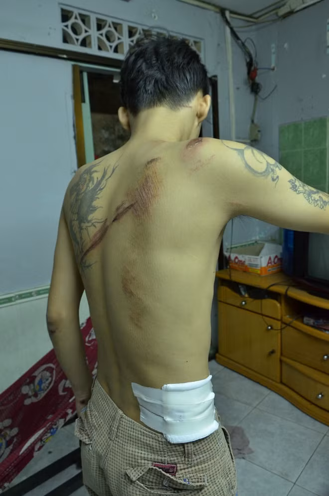 Và bị chém khu vực vùng lưng, hông.