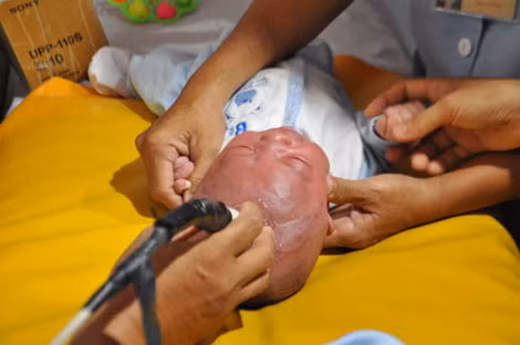 Các chỉ số về điện não là bình thường.