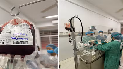 Bất đồng nhóm máu với mẹ, bé sơ sinh phải thay máu toàn phần